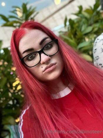 albinoteen