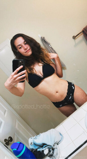 spottedhottie21